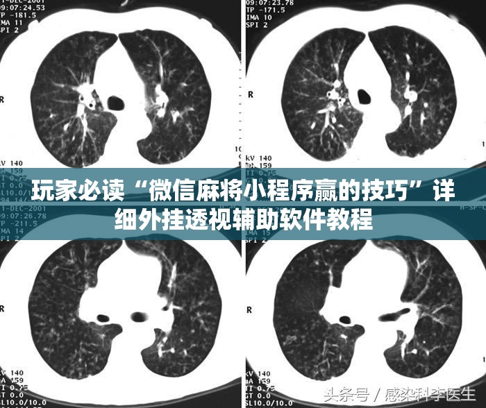 玩家必读“微信麻将小程序赢的技巧”详细外挂透视辅助软件教程